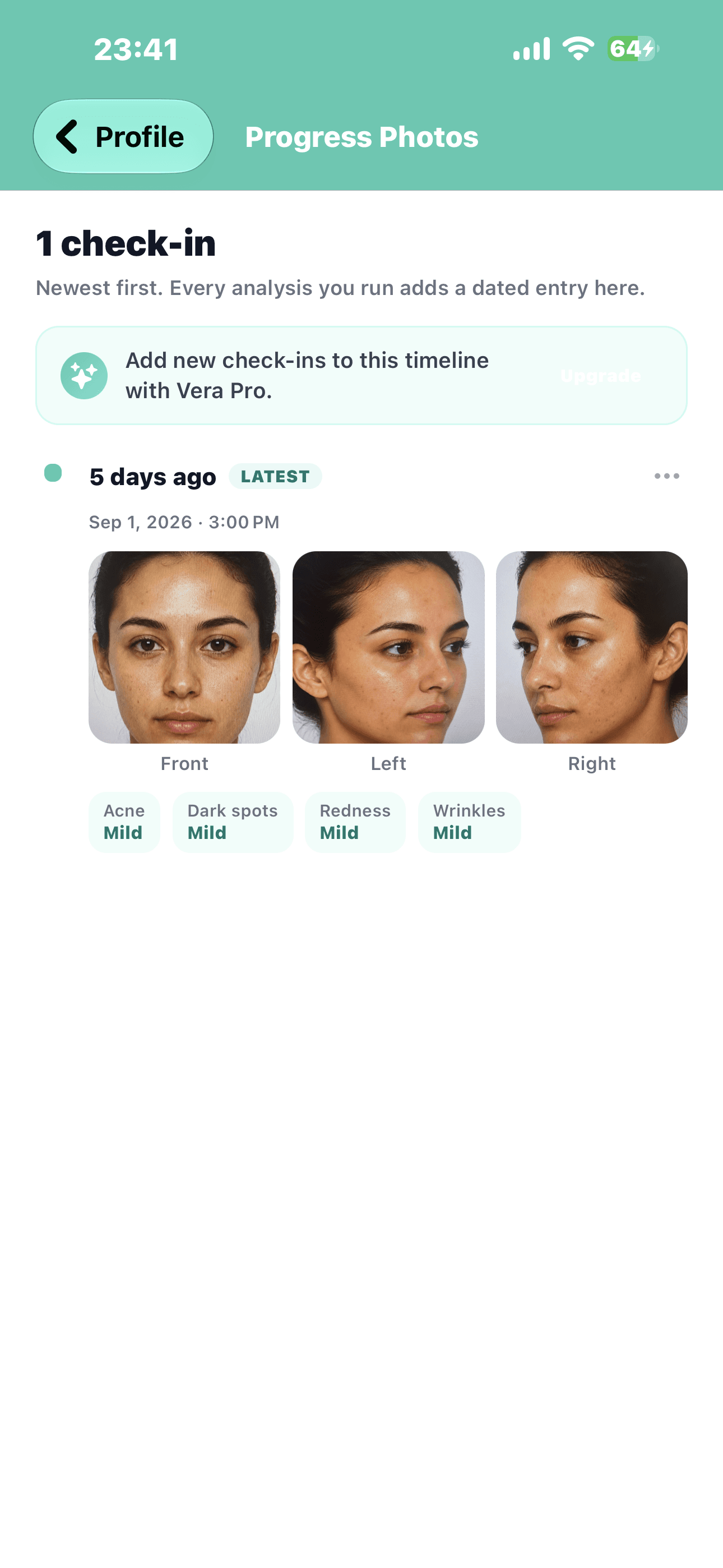 Screenshot of the Vera progress photos screen: a dated check-in with front, left and right captures, each concern rated mild.